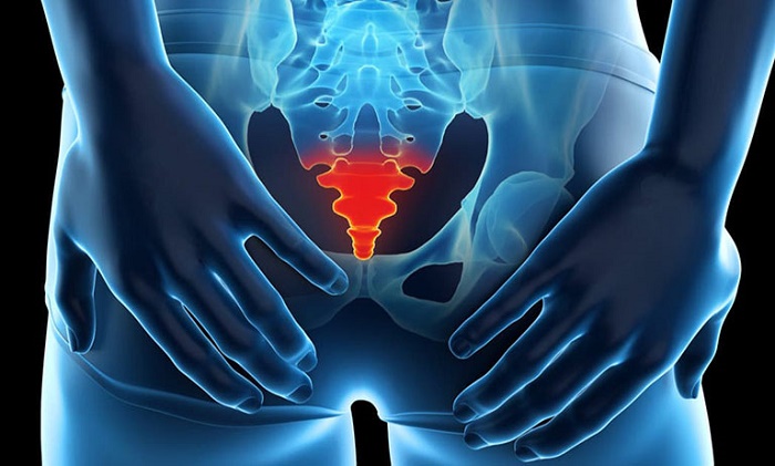 Bài tập chữa Đau Xương Cụt vật lý trị liệu