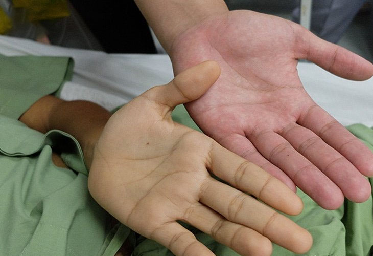 Cây Mật Gấu: Tác Dụng Và Cách Sử Dụng Hiệu Quả