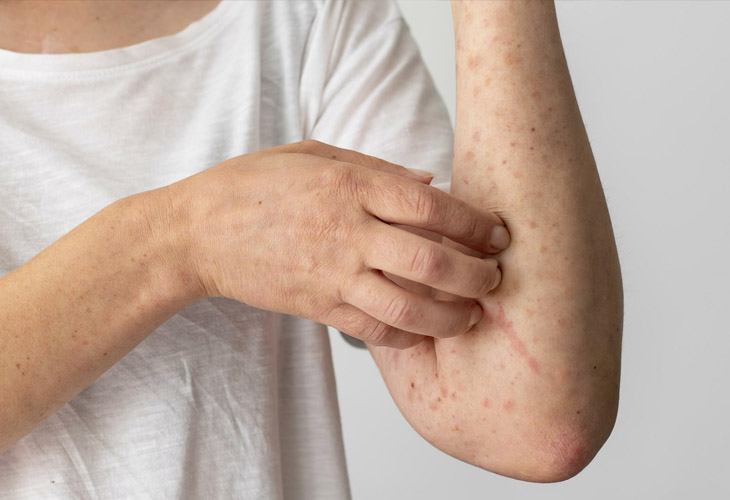 Cây Mật Gấu: Tác Dụng Và Cách Sử Dụng Hiệu Quả