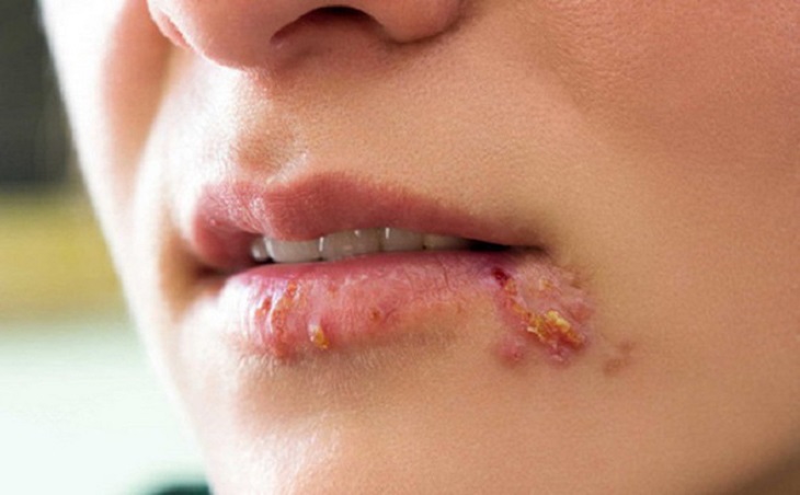 Cia Là Gì? Cum In Alo Có An Toàn Không, Có Sướng Không?