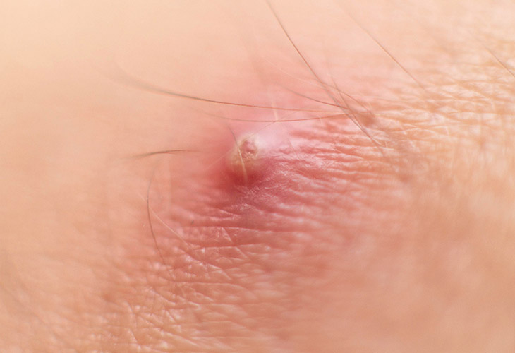 Cỏ Chân Vịt - Đặc Điểm Tự Nhiên Và Hiệu Quả Thanh Nhiệt