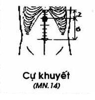Huyệt Cự Khuyết