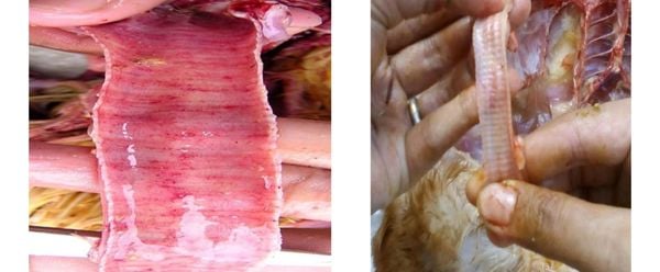 Xuất huyết khí quản