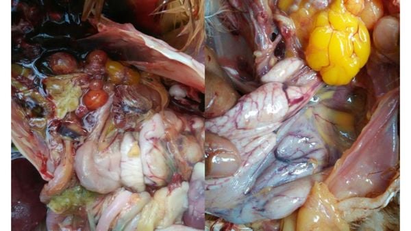 Buồng trứng xuất huyết