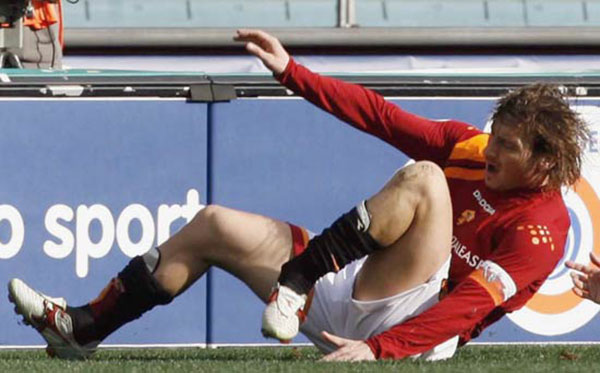 Gãy Ống Đồng Là Gì? Nguyên Nhân, Dấu Hiệu Và Lộ Trình Hồi Phục